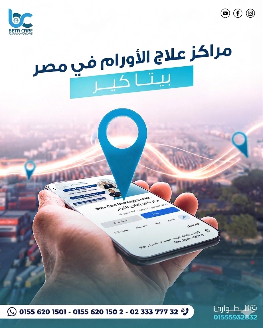 مراكز علاج الأورام في مصر