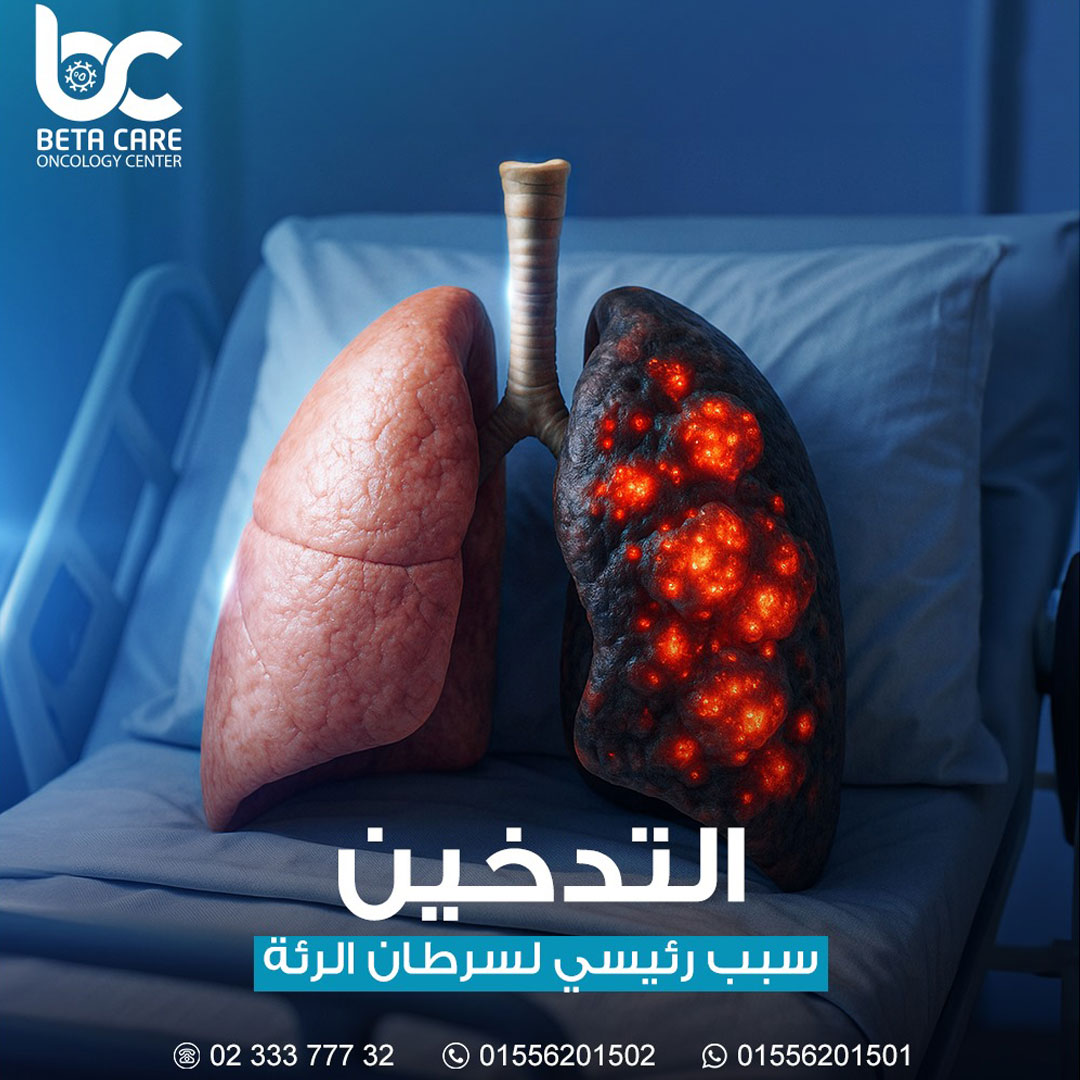 هل التدخين يسبب سرطان الرئة