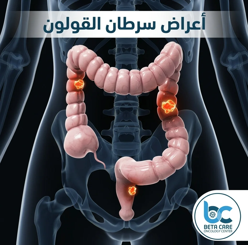 اعراض سرطان القولون